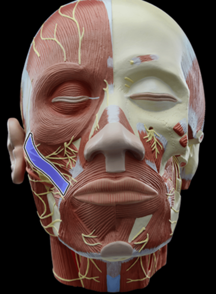 <p>What Muscle Is Highlighted?</p>