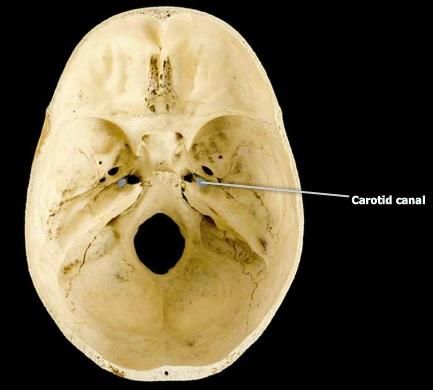in temporal bone