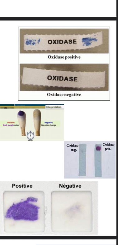 <p>Oxidase Test</p>