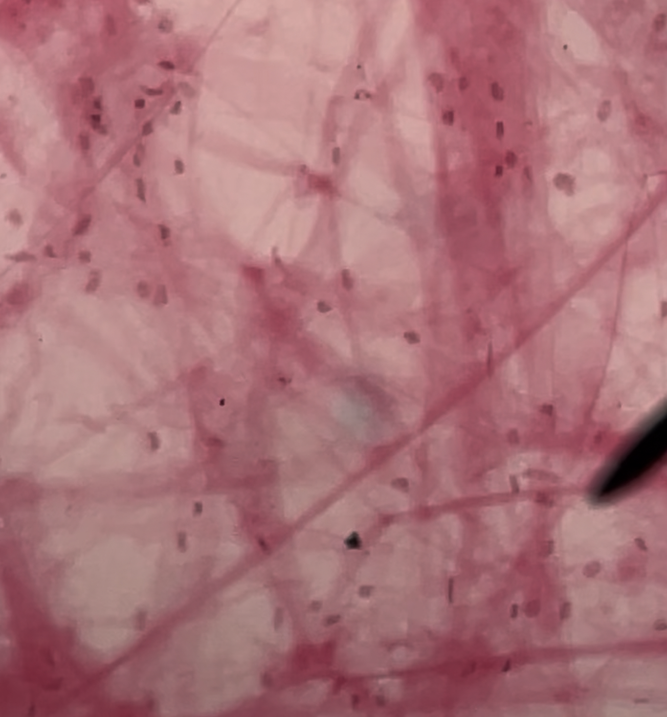 <p>Type of Tissue?</p>