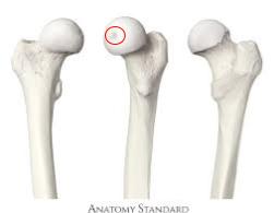 <p>Indentation on the femur head</p>