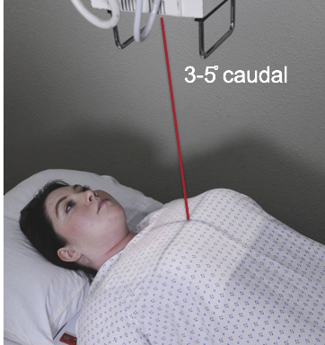 <ul><li><p>CR is perpendicular to long axis of sternum directed to T7 (3-4” below jugular notch) perpendicular to IR</p></li><li><p>Supine pt: angle CR 3-5 degrees caudal</p></li></ul><p></p>