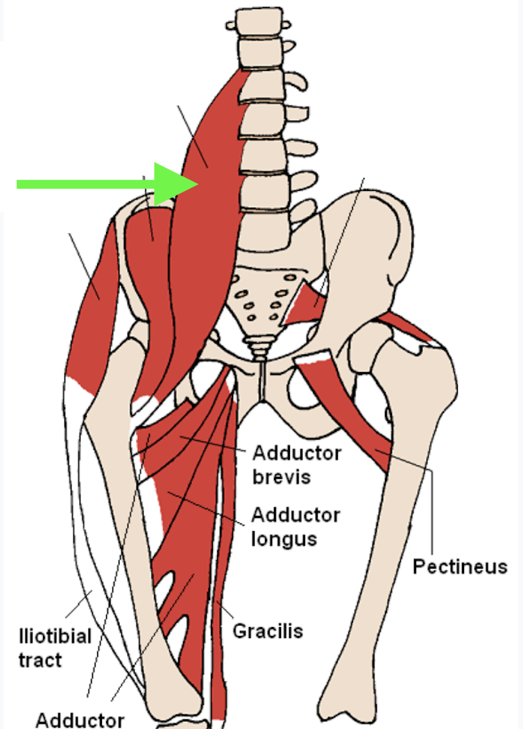term image