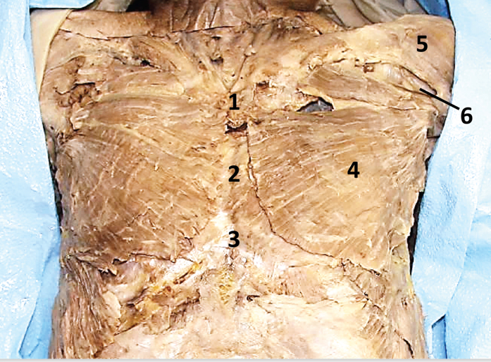 <p>Superficial muscle in thorax (innervated by medial and lateral pectoral nerves) - Include number in diagram</p>