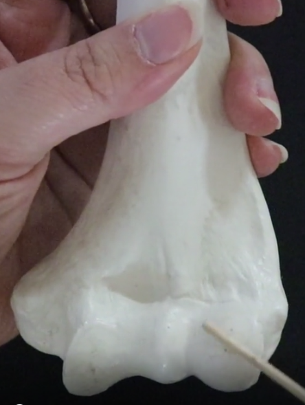 <p>capitulum = The lateral portion of the articular surface of humerus consists of a smooth, rounded eminence</p><p></p><p>articulates with the head of the radius</p><p></p><p>a lateral condyle on the distal end o the humerus that articulates with the head of the radius. this joining allows for pronation/supinaion of the foreamen</p>