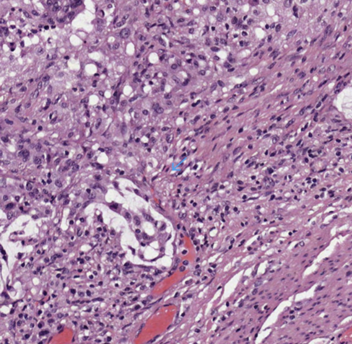 <p>Colon</p>