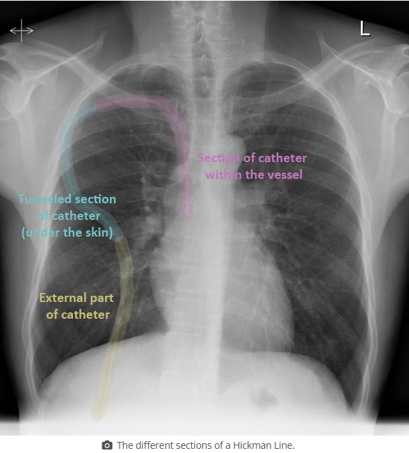 <p>see picture</p>