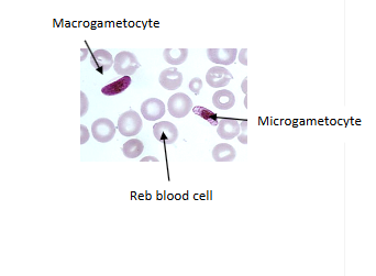 <p><span>What is the genus, species, and stage of this parasite?</span></p>