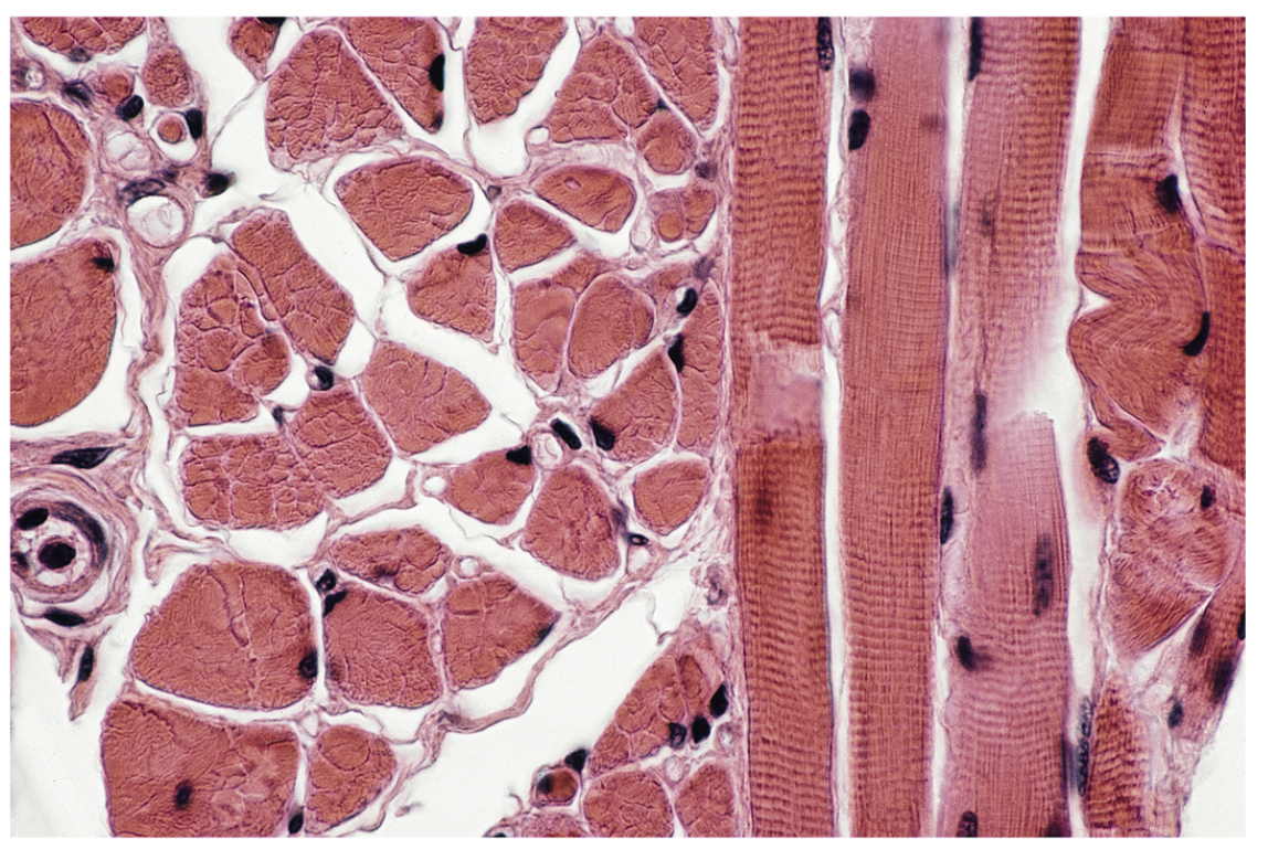 <p>Name the tissue.</p>