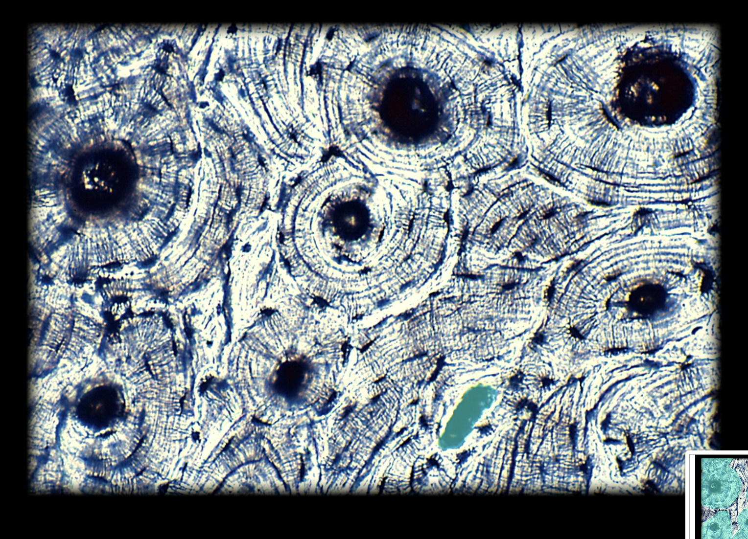 <p>Perforating Canal</p>