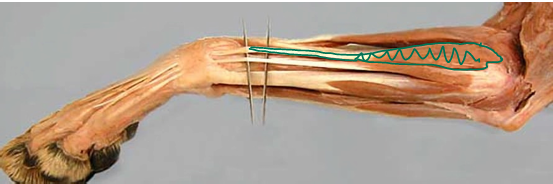 <p><span>Antebrachial Region (Forearm)</span></p>