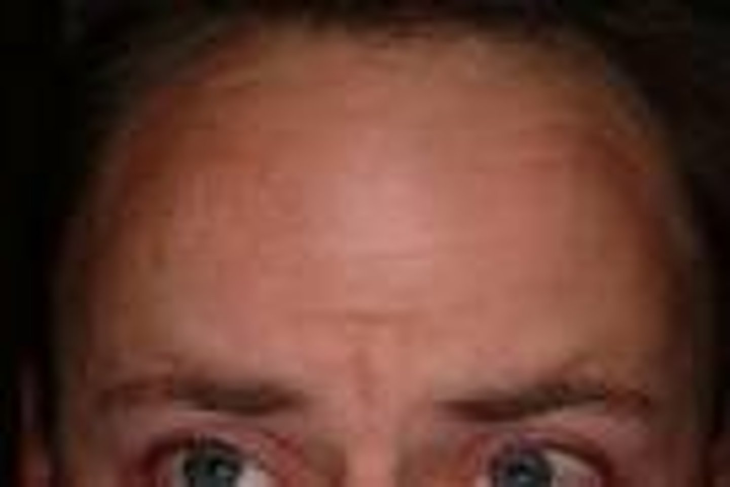 <p>the forehead</p>