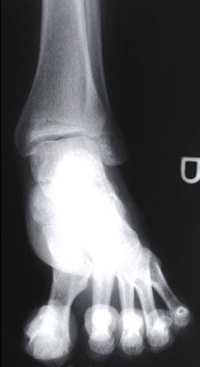 <p>AP</p><p>3 multiple choice options</p>