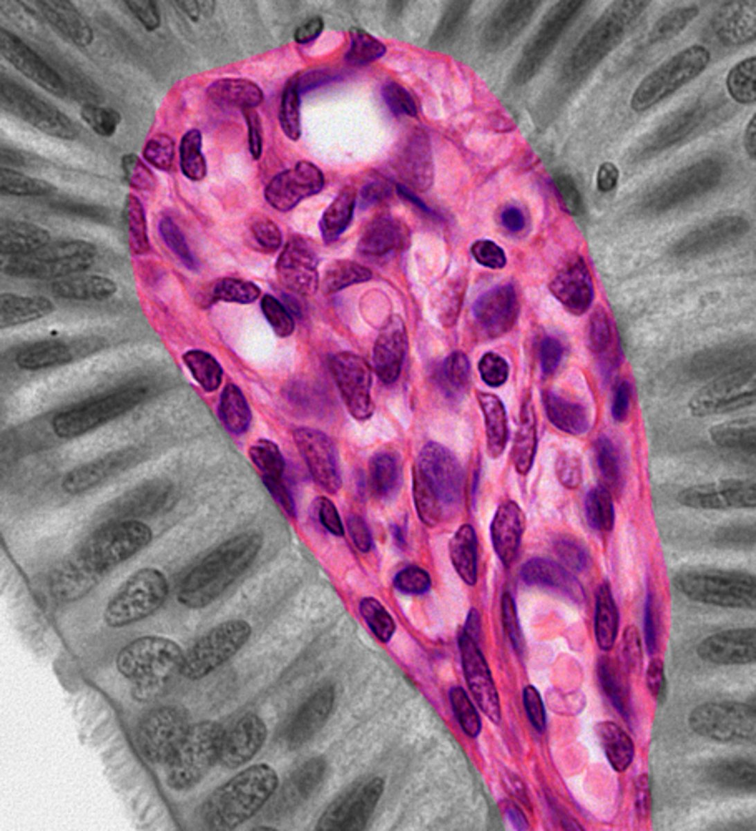 <p>ex. adipose</p><p>few CT fibres, more ground substance</p>