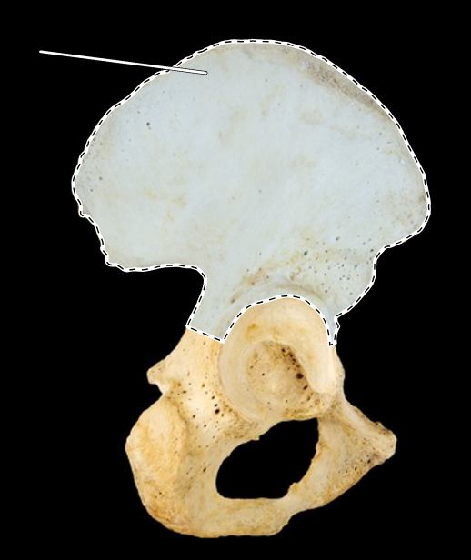 <p>Name this bone.</p><p>(Lateral view, right).</p>