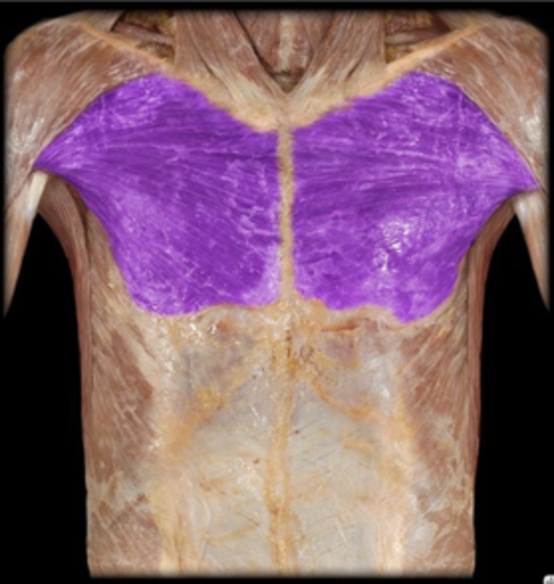 <p>What is the name of this muscle, highlighted in purple?</p>