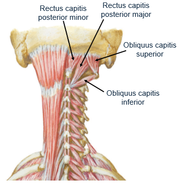 <p>inferior nuchal line</p>
