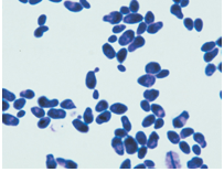 <ul><li><p>medically important yeast</p></li><li><p>causes yeast infection = candidiasis</p></li><li><p>vaginal area, mouth (causes thrush)</p></li><li><p>normally comes and goes</p></li><li><p>systemic in blood may result in endocarditis (may live 3-4 days)</p></li><li><p>antifungles usually work (nystatin)</p></li><li><p>most susceptible to Candida infections: diabetics, those w/ immunodeficiency, catheterized patients, infants, individuals taking antimicrobial medications</p></li></ul><p></p>