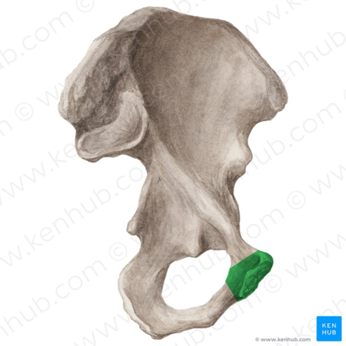 <p>corpus ossis pubis</p>