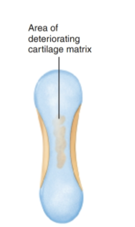 <ol><li><p><strong>Chondrocytes</strong> from the <strong>primary ossification center</strong> ossify surrounding cartilage</p></li><li><p><strong>Chondrocytes</strong> die and the <strong>matrix begins to dissolve</strong></p></li><li><p><strong>Cavities</strong> are now formed within the model</p></li><li><p><strong>Remaining cartilage (ends)</strong> stay healthy and grow rapidly to <strong>elongate the model</strong></p></li></ol><p></p>