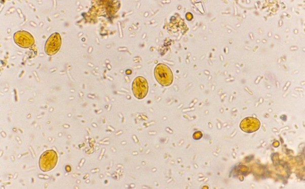 <p><em>Giardia</em> infective stage</p>