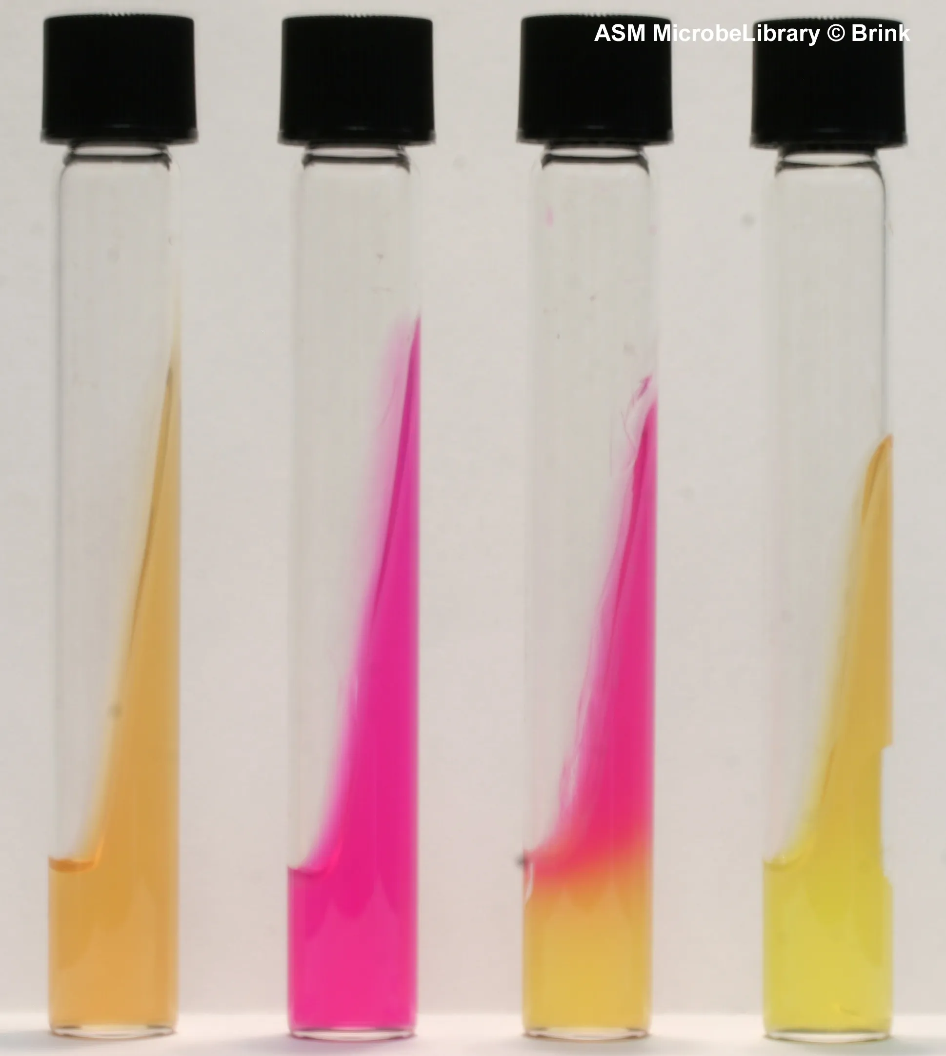 <p>Urease test interpretation</p>