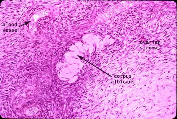 <p>En rest från corpus luteum. Uppstår när det slutar producera progesteron och fibrotiseras. <u><img src="https://lh4.googleusercontent.com/ZzpQOb8xnzD2Tlxfofv1xs8OLb-qG_fpLCq1bDrxPu1FKJQB37C4sljCTzwnxtehmii448G-KEPq7AGZS6ZlQtSAI8iUkvkuPaQD0gAiINxHIXK14DNYiILc8IS8HWdeTes9bq62m-xOTK36AsgUX18" width="312" height="208"></u></p>