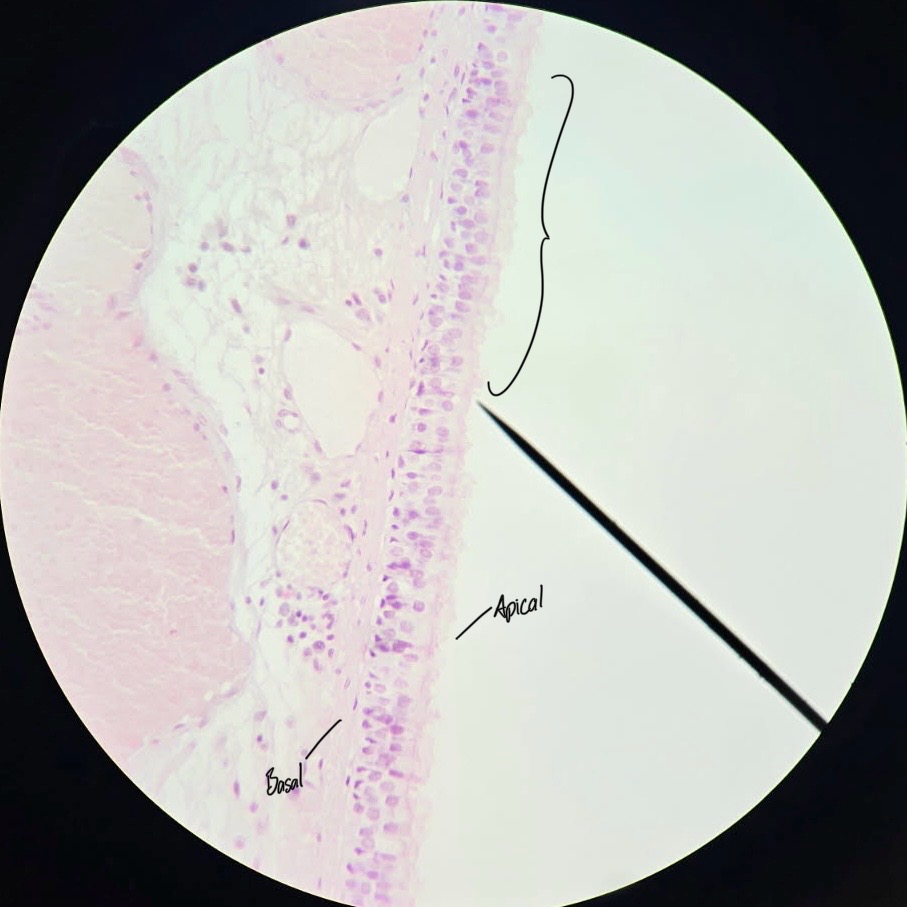 <p>Pseudostratified Ciliated Columnar Epithelium</p>