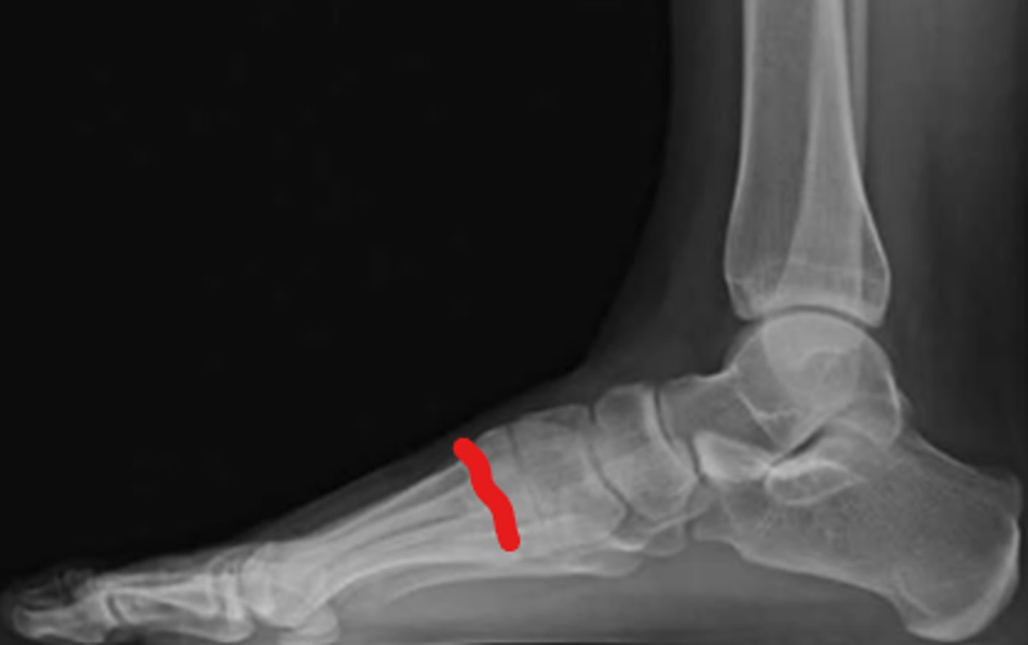 <p>What joint is this?</p>