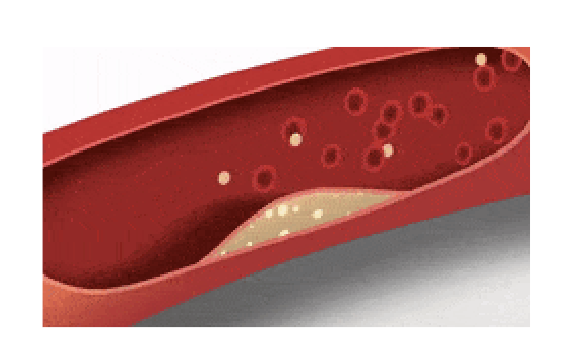 <ul><li><p><strong>Substances</strong> that <strong>dissolve</strong> <strong>formed</strong> <strong>blood</strong> <strong>clots</strong></p></li><li><p>Works by turning <strong>plasminogen </strong>into <strong>plasmin</strong></p><ul><li><p><strong>Plasmin</strong> then breaks down the blood clot through <strong>fibrinolysis</strong></p></li></ul></li></ul><p></p>