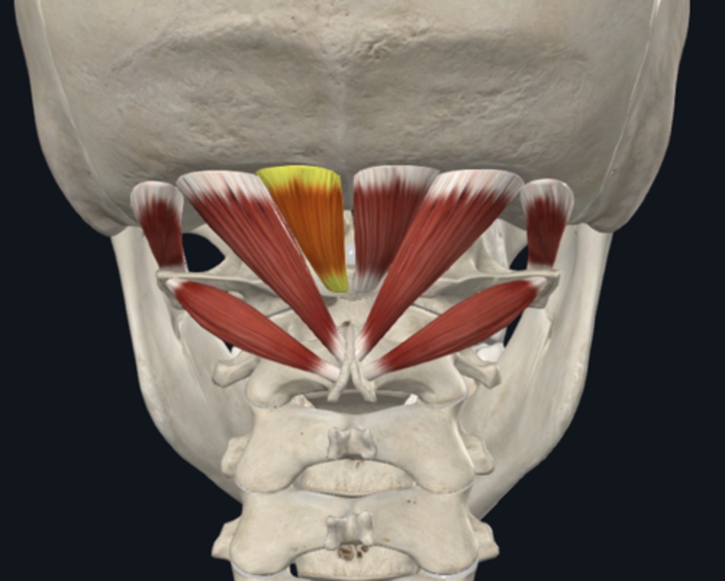 <p>What is the attachment of the Rectus capitis posterior minor muscle of the suboccipital muscles?</p>
