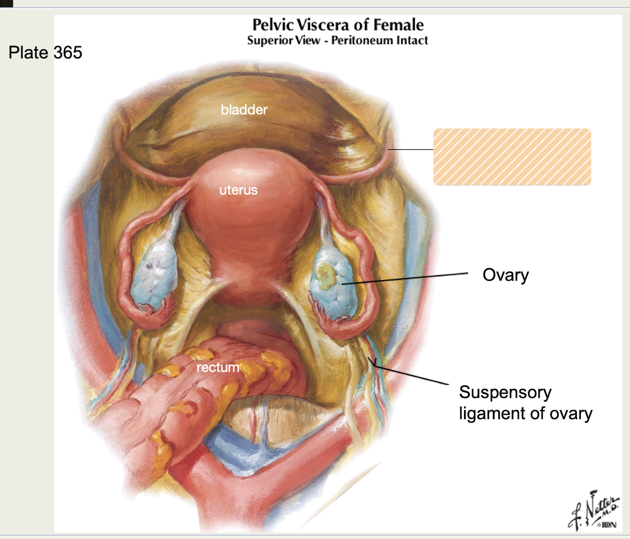 <p>-Bilateral peritoneum attaches to <strong>superior lateral wall of uterus </strong></p><p>-Runs <strong>through inguinal canal, attaches to labia majora</strong></p><p><em>aka ligamentum teres</em></p>