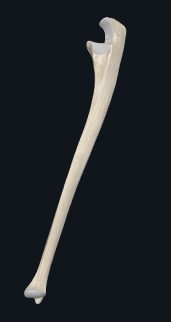 <p>What is this bone called</p>