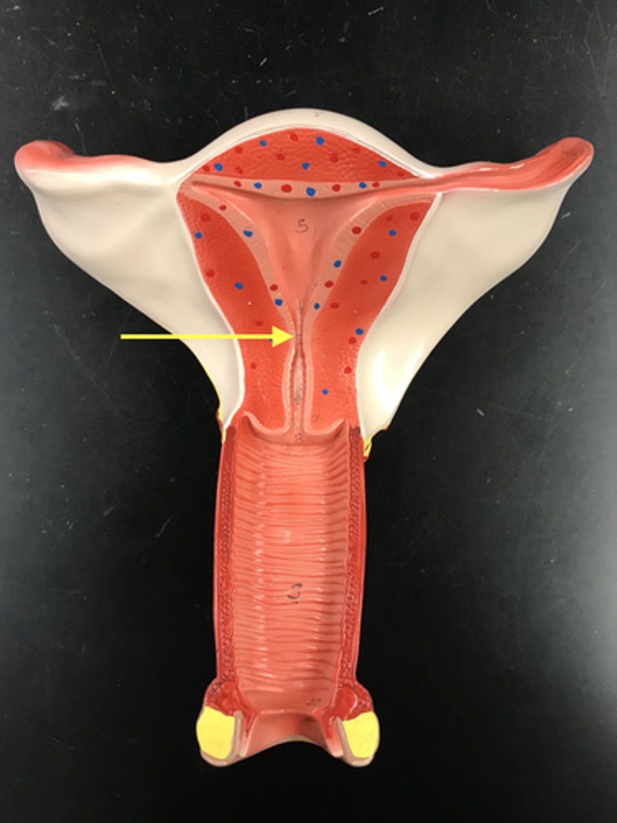 <p>Narrowing at the top of the cervix</p>