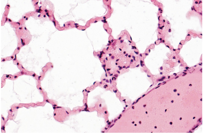<p>Simple Squamous Epithelium</p>