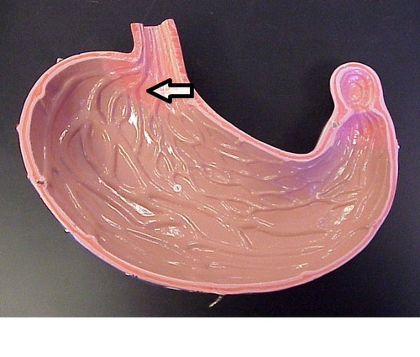 <p>The area of the stomach closest to the esophagus.</p>