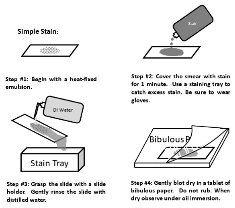 <p>A simple stain is when we use a positively-charged dye to stain the negatively-charged bacteria and view them easily under the brightfield lens</p>