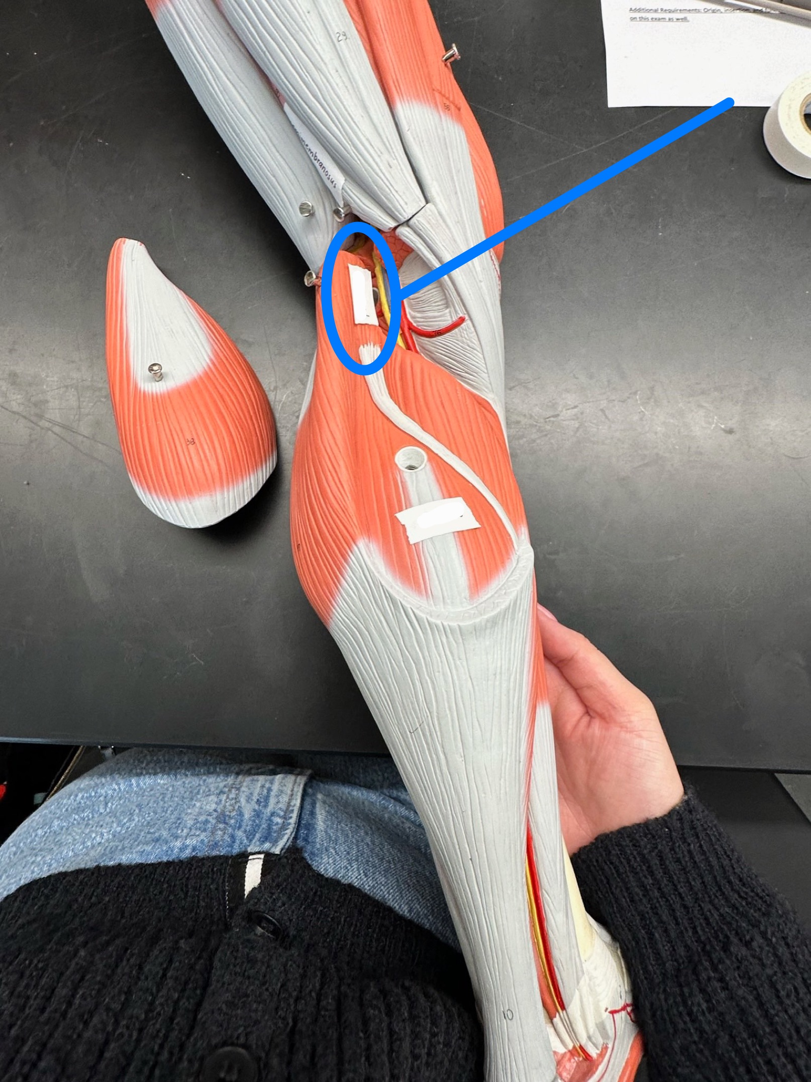 <p>ID muscle</p>