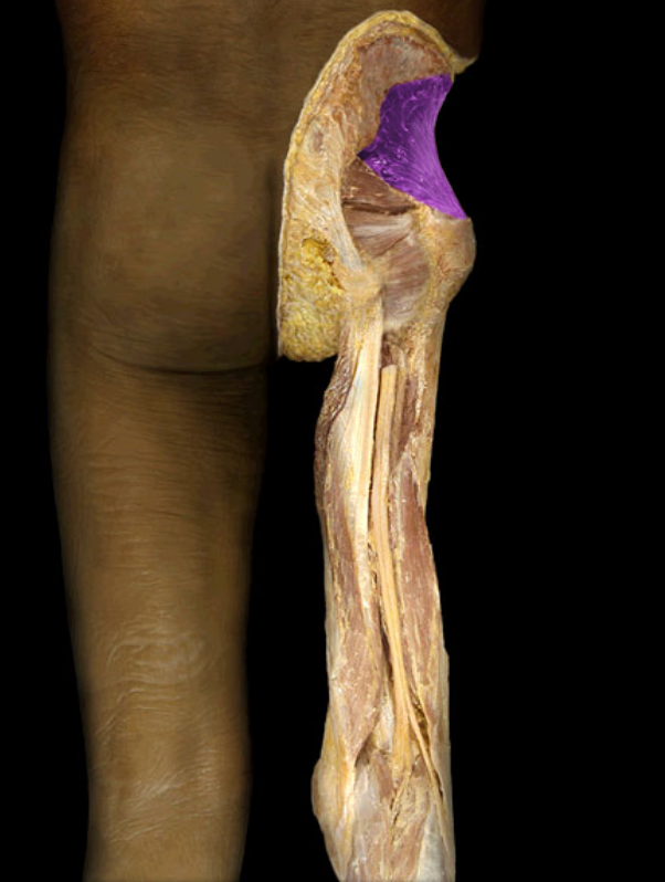 <p>deep to gluteus medius</p>