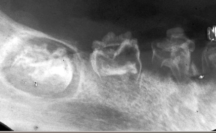 <ul><li><p>Nonhereditary developmental anomaly</p><ul><li><p>Most believe it is due to an alteration in vascular supply</p></li></ul></li><li><p>Most commonly involves maxillary anterior teeth</p></li><li><p>Usually involves one quadrant; rarely can affect more</p></li><li><p><strong>Very large pulps with minimal dentin &amp; enamel</strong></p></li></ul><p></p>