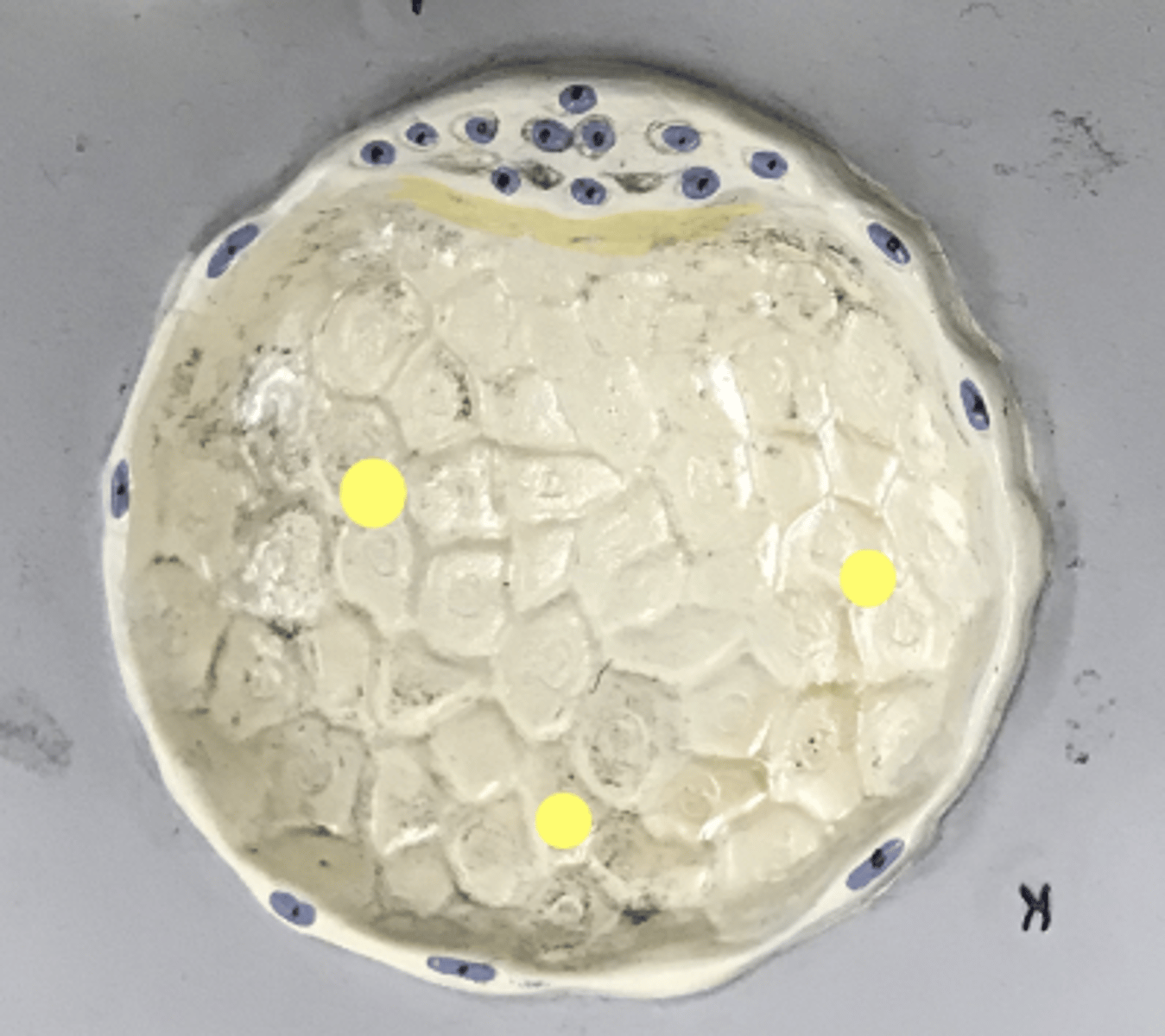 <p>The space or cavity inside the blastocyst</p><p>Name this SPACE</p>