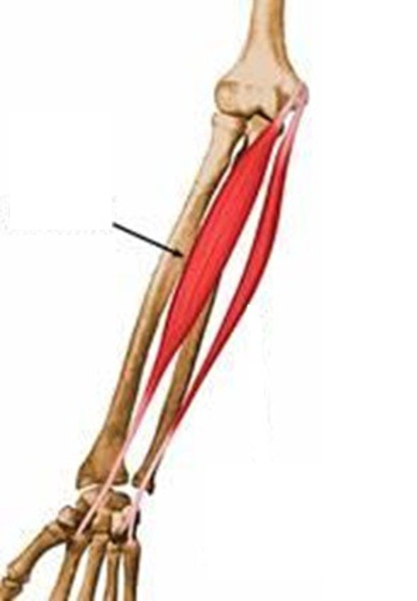 <p>runs diagonally across forearm</p><p>o: medial epicondyle of humerus</p><p>i: bases of 2nd and 3rd metacarpal bones</p><p>a: POWERFUL FLEXOR OF WRIST; ABDucts HAND</p>