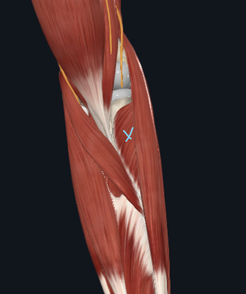 <p>What muscle is this</p>
