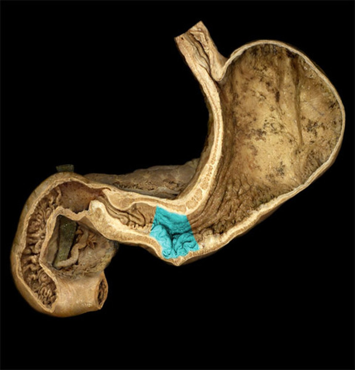 <p>what is highlighted in this image?</p>