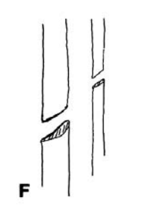 <p>Indirect fractures Agulation + rotation + compression </p>