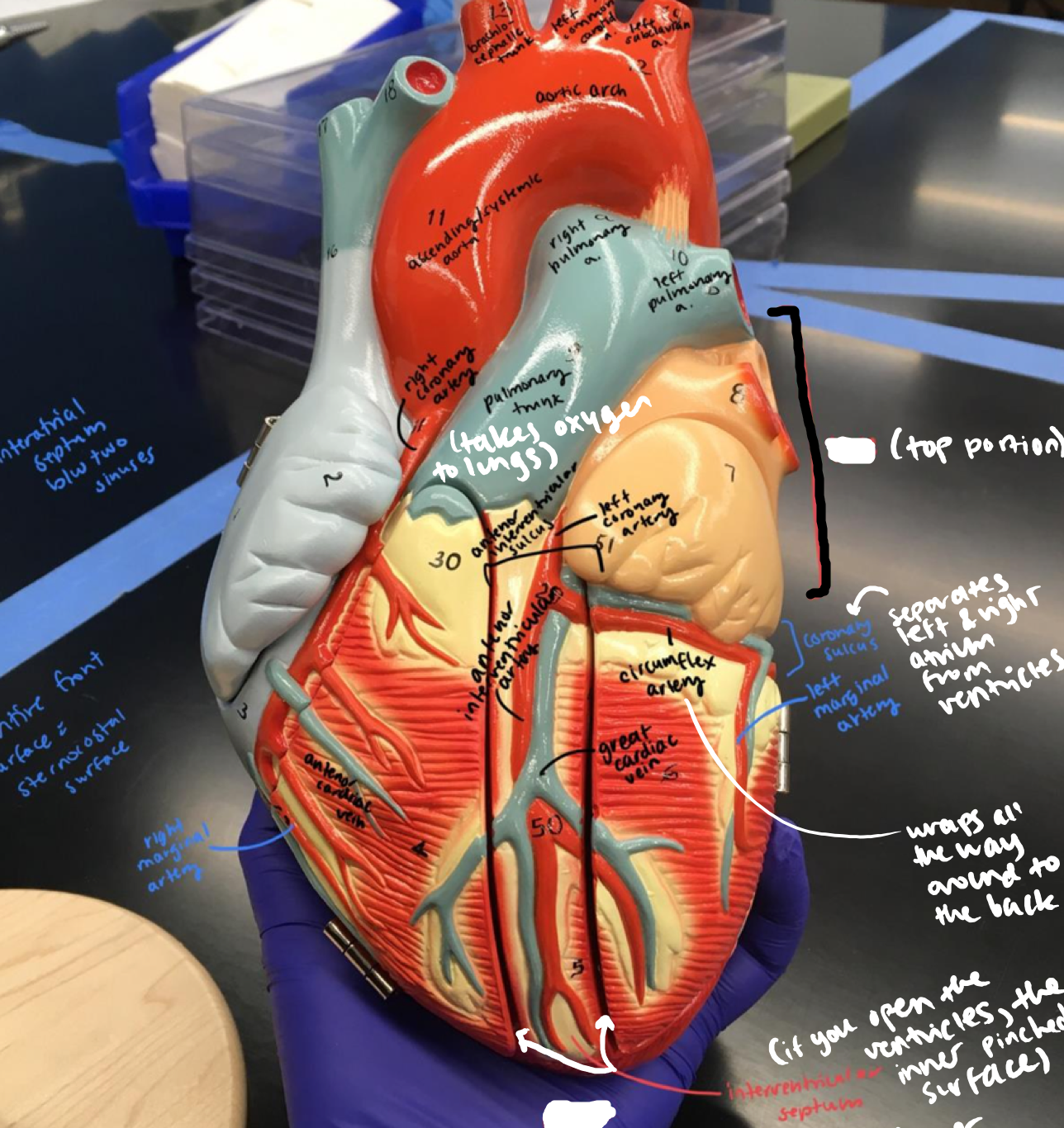 <p>Top portion of the heart</p>