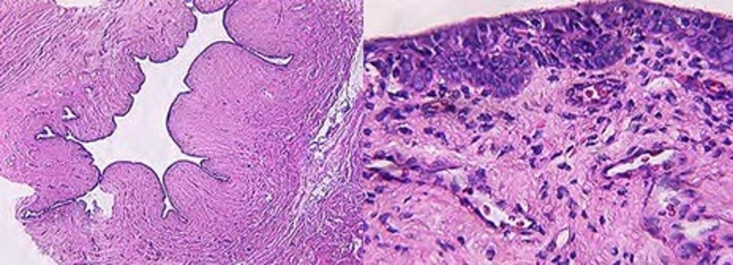 <p>Identify the organ, its function &amp; list the tunica and their characteristics</p>