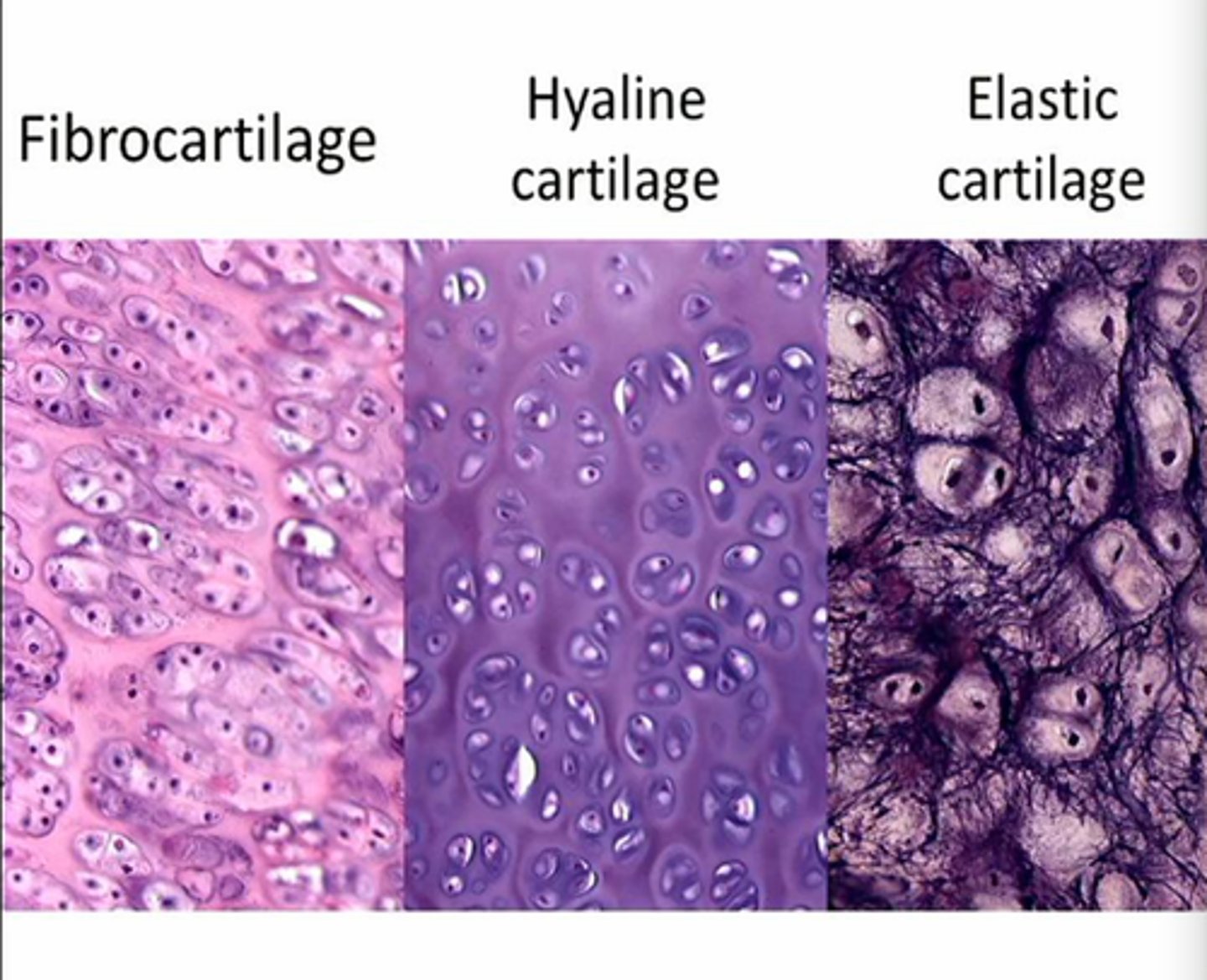 <p>Hyaline (joints, nose), Elastic (ear, epiglottis), Fibrocartilage (discs, pubic symphysis)</p>