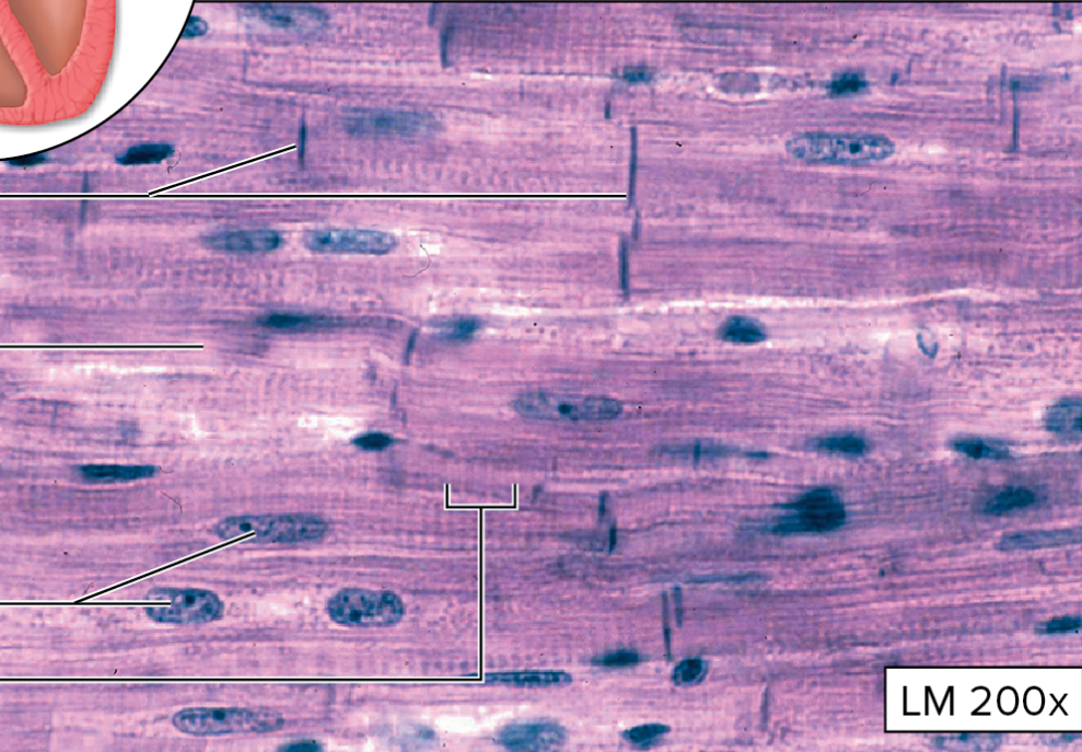 <p>What type of muscular tissue is this?</p>