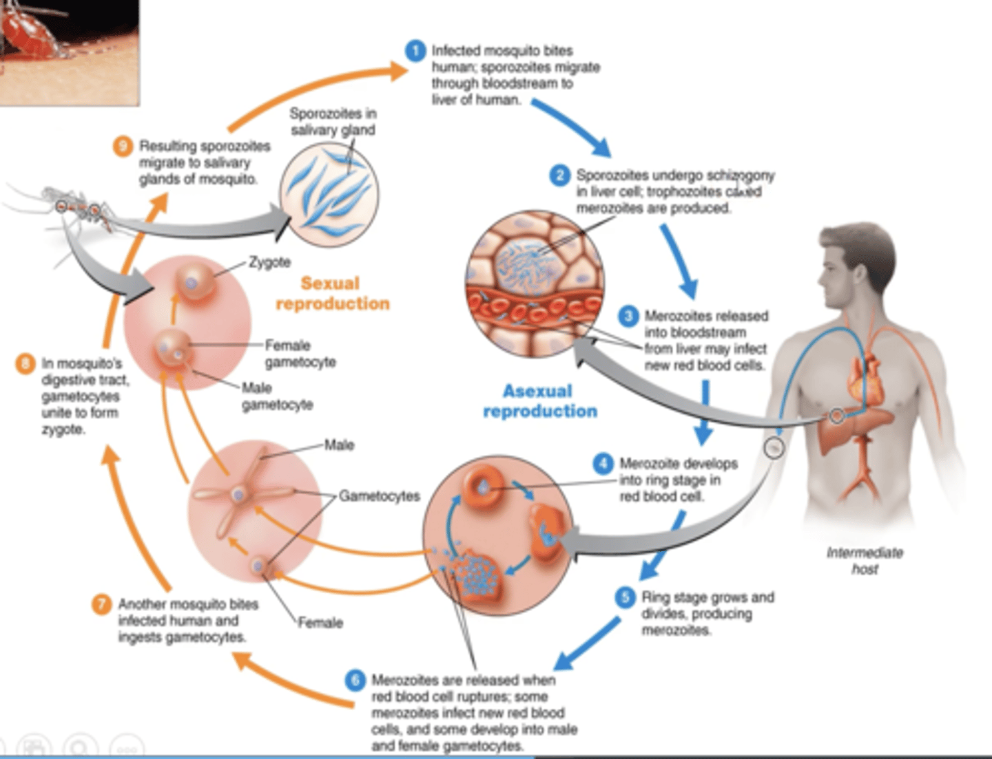 <p>malaria</p>